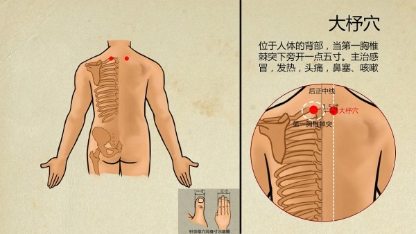 咽喉肿痛怎么办
