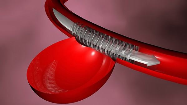 混合性脂质失调与家族史的关系