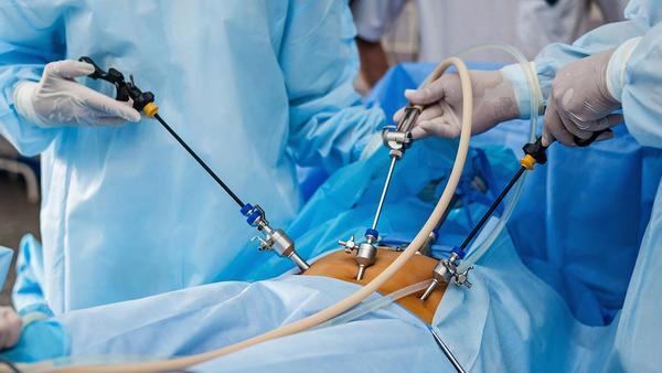 高血压的控制和管理策略