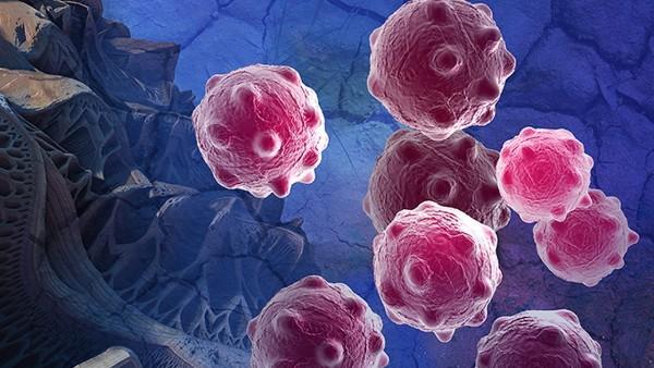 狼疮性肾炎的抗体检查