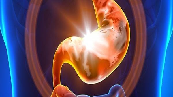 胆结石会引发黄疸吗