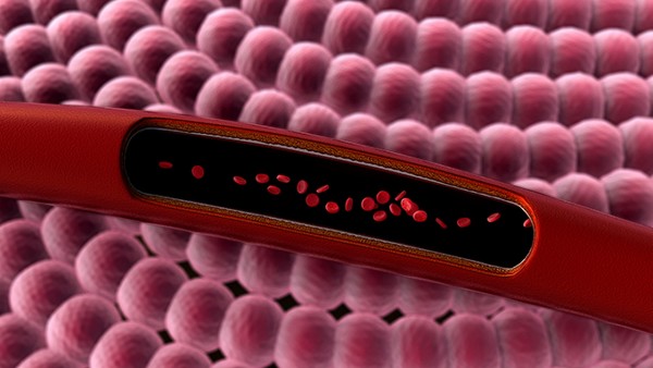 超声波能检查出肺栓塞吗？