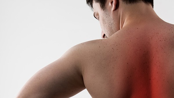 黄褐斑和雀斑的区别