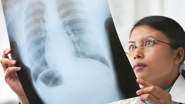 疟疾的防蚊药使用建议