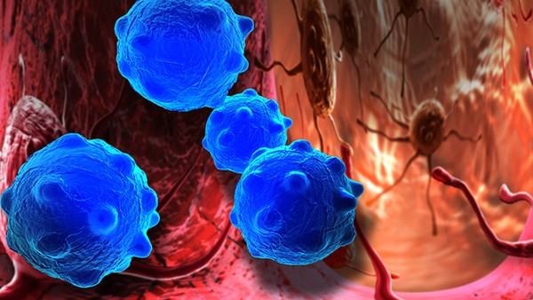 喉癌的声音嘶哑