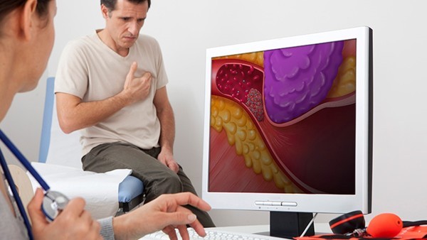 关节炎患者可以做哪些运动