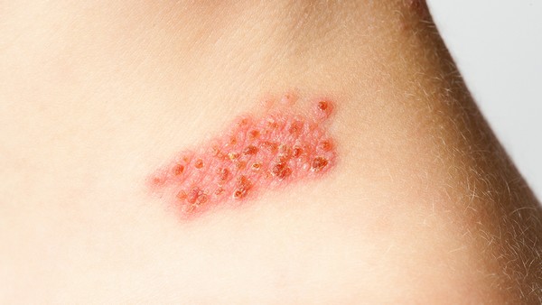 抑郁症有哪些常见的心理表现