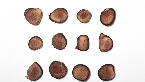 多囊卵巢综合症的诊断标准