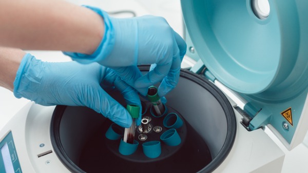 高钙血症的药物与饮食的相互作用