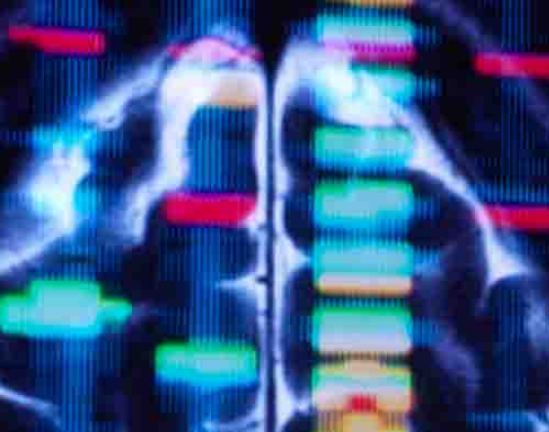 华辉安健将在AASLD 2025年会公布立贝韦塔单抗最新临床成果