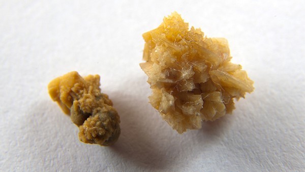 新冠感染的疫苗种类