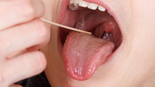 新冠肺炎恢复期有哪些症状？咳嗽、乏力与康复管理建议